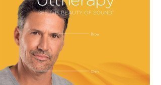 Ultherapy